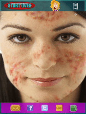 Скриншот приложения Acne Pimples Kiosk © HD Lite - №2