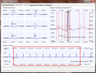 Скриншот приложения ECG Control - №1