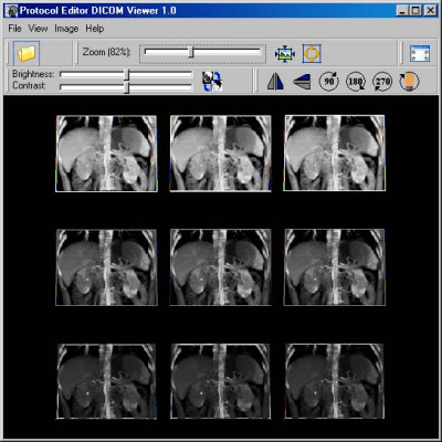 Скриншот приложения DICOM Viewer - №1